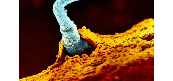 Оплодотворение: сперматозоид преодолел все препятствия и соединился с яйцеклеткой. Чтобы эта жизненно важная задача была счастливо завершена, необходимы, помимо прочего, прогестерон, кальций и, как выяснилось, их белковый посредник. Изображение с сайта thelocal.de