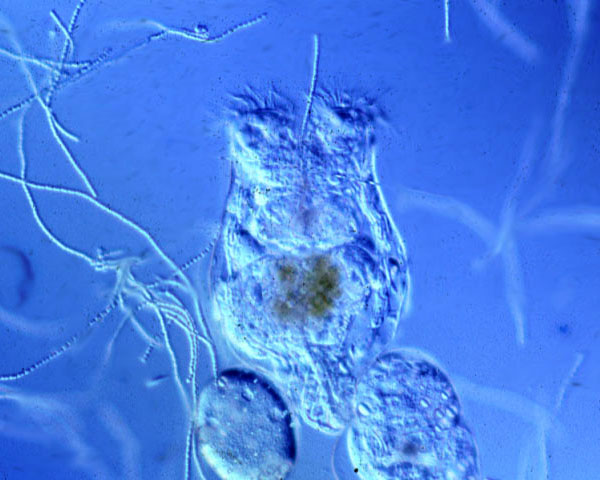 Коловратка Brachionus calyciflorus поедает колонию (трихом) нитчатых цианобактерий Anabaena. Коловратка несет на себе два крупных партеногенетических яйца. Фото с сайта www.uv.es