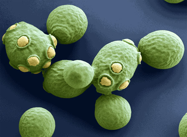 Дрожжи Saccharomyces cerevisiae: желтые пятна — это след отпочковавшейся дочерней клетки. В эукариотической клетке дрожжей имеется 6704 гена, из них 2460 имеют прокариотическое происхождение. Среди «прокариотных» генов 952 — эубактериальные гомологи, а 216 — архейные гомологи. Фото с сайта www.microbiologyonline.org.uk