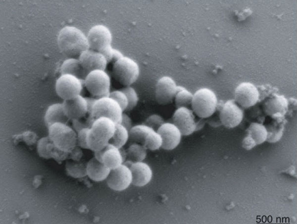 Бактерии с химически синтезированным геномом (на фото) быстро размножаются и внешне практически не отличаются от «диких» бактерий Mycoplasma mycoides. Изображение из обсуждаемой статьи в Science