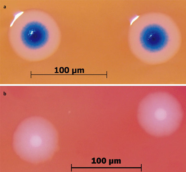 Колонии бактерий с синтетическим геномом (вверху) окрашены в синий цвет, потому что их геном содержит ген lacZ, кодирующий фермент бета-галактозидазу. В питательной среде есть вещество X-gal, превращаемое этим ферментом в синий краситель (5,5`-дибромо-4,4`-дихлоро-индиго). «Дикие» бактерии M. mycoides (внизу) не имеют этого гена, поэтому их колонии остаются белыми. Рисунок из обсуждаемой статьи Gibson et al. в Science
