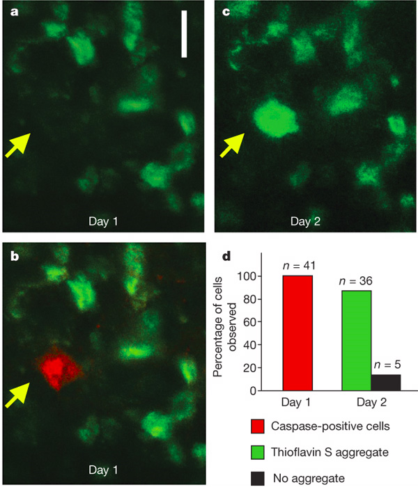 Индикатор на нейрофибриллярные клубки тиофлавин S (зеленый) и каспазный индикатор (красный) на первый (a, b) и второй (c) день после добавления красителей на поверхность мозга. Стрелочкой показано, что на второй день в «каспазно-бесклубочковом» нейроне возникает нейрофибриллярный клубок. d — на гистограмме видно, что в большинстве (88%) «каспазно-бесклубочковых» нейронов в течение суток появляются клубки. Длина масштабной линейки 10 мкм. Изображение из обсуждаемой статьи в Nature