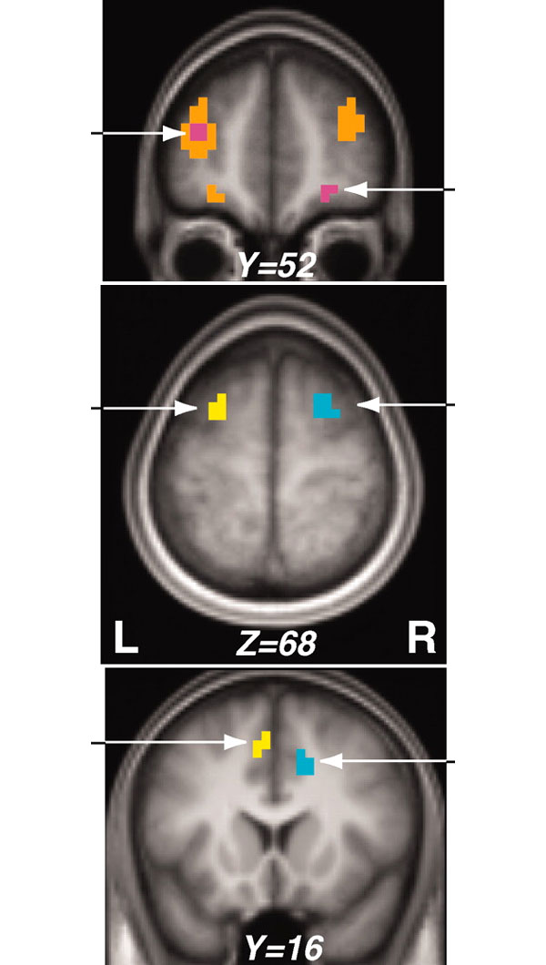 Области мозга, в которых отображается информация о награде при выполнении «двойных» заданий. Изображение из обсуждаемой статьи в Science