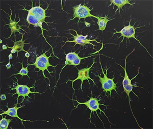 Культура предшественников нервных клеток человека послужила основой для исследования функций гена FOXP2. Фото с сайта louisville.edu
