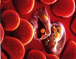 Малярийный плазмодий в эритроцитах человека. Фото с сайта www.iayork.com