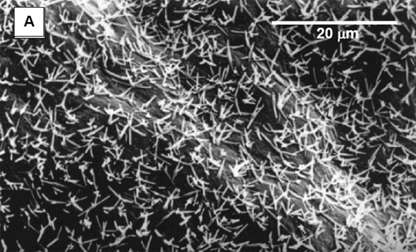 Кристаллы карбоната на поверхности кишечного эпителия европейской речной камбалы (Platichthys flesus) под сканирующим электронным микроскопом. Длина масштабной линейки — 20 мкм. Рис. из дополнительных материалов к обсуждаемой статье в Science