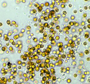 Симбиотические водоросли Symbiodinium kawagutii в культуре под световым микроскопом. Фото Scott R. Santos с сайта www.auburn.edu