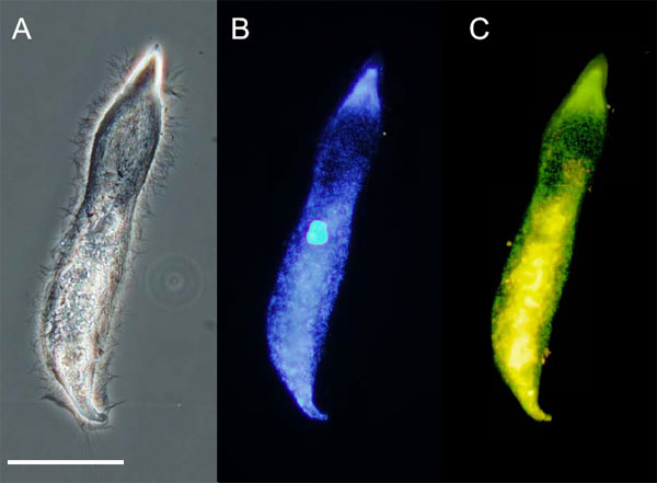 Pseudotrichonympha grassi — представитель симбиотических простейших (особой группы жгутиковых — гипермастигин), обитающих в кишечнике термита. A — под микроскопом в фазовом контрасте. B — то же при окраске люминесцентным красителем, выявляющим ядро. C — то же при использовании метода FISH (fluorescence in situ hybridization); зеленым цветом выделяются бактерии — внутриклеточные симбионты простейших, желтым — масса перерабатываемой древесины. Длина масштабной линейки 100 мкм. Фото из дополнительных материалов к обсуждаемой статье в Science
