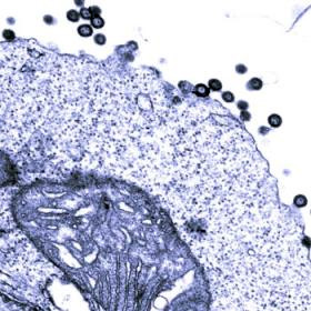 Повинуясь указаниям ретровируса, встроившегося в ее геном, клетка послушно производит новые ретровирусные частицы (темные кружки). Фото с сайта www.physorg.com