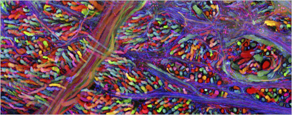 Клетки мозга лабораторной мыши, светящиеся разными цветами за счет внедренных в их хромосомы в разных сочетаниях флуоресцентных белков трех разных цветов, полученных на основе зеленого флуоресцентного белка. Роджер Цянь, разделивший Нобелевскую премию по химии 2008 года с двумя другими учеными, изучил физико-химические причины свечения зеленого флуоресцентного белка и с помощью прицельных мутаций в его гене получил гены флуоресцентных белков других цветов. Использование таких белков, в частности, облегчает изучение связей между множеством нейронов головного мозга. Фото © AP Photo/Harvard University, Livett-Weissman-Sanes-Lichtman с сайта www.nytimes.com