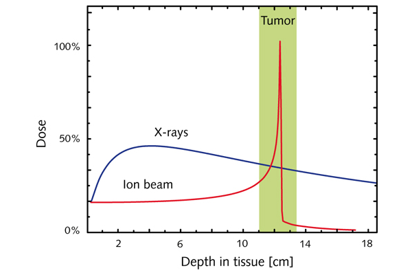 Доза облучения, получаемая тканями на разной глубине при облучении рентгеновскими лучами и пучком ионов (изображение с сайта www.gsi.de)