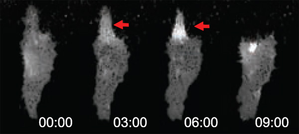 Под воздействием белка Wnt на одном из концов клетки меланомы формируется молекулярный комплекс W-RAMP (светлое пятно, отмеченное красной стрелкой). Вскоре после этого, на 9-й минуте эксперимента, происходит втягивание мембраны. Фото из обсуждаемой статьи в Science