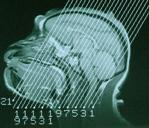 С помощью магнитно-резонансной томографии стало возможно изучение способов коммуникации не только у человека, но и у других приматов. Фото с сайта psych.wisc.edu