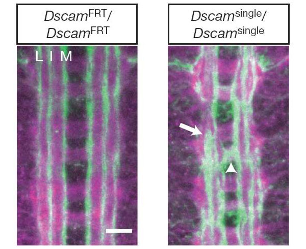 Брюшная нервная цепочка нормального мушиного эмбриона (слева) и мутантного, способного производить только одну изоформу белка DSCAM (справа). Стрелками показаны участки наиболее выраженных патологических изменений. Масштаб — 10 мкм. Фото из статьи в Nature