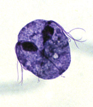 На этой фотографии жгутиконосец Trichomonas vaginalis изображен в процессе клеточного деления (он делится вдоль). Фото с сайта www.k-state.edu