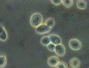  Saccharomyces (   www-micro.msb.le.ac.uk)