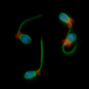 Хоанофлагелляты — предполагаемые одноклеточные предки животных (фото с сайта mcb.berkeley.edu)