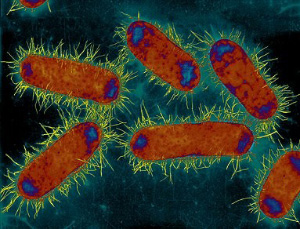 Многочисленные отростки на поверхности клеток E.coli относятся к числу «необязательных для жизни» структур. Гены, отвечающие за их образование, могут быть удалены без ущерба для бактерий, выращиваемых на искусственных средах в лаборатории (фото с сайта www.astrosurf.org)