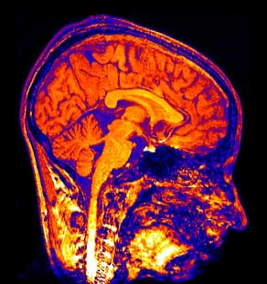 Магнитно-резонансная томография позволяет следить за работой отделов мозга и даже отдельных нейронов (фото с сайта homepage.psy.utexas.edu)