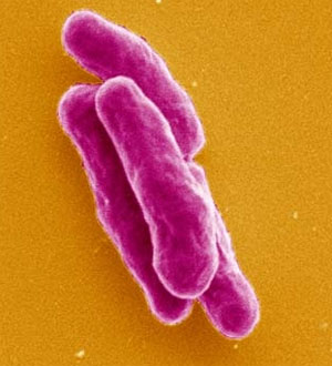        .  : Mycobacterium tuberculosis,   (   www.microscopyconsulting.com)
