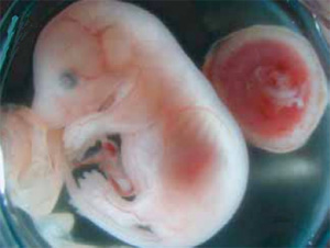 Плацента (красный круг справа) позволяет и людям, и этому мышонку проводить начало жизни в животе у матери. Возможно, этот замечательный орган никогда бы не появился, если бы наши далекие предки не подхватили где-то очень странную заразу (фото из статьи в Nature genetics)