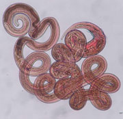 Круглые черви могут защищать от астмы и аллергии, ослабляя иммунную реакцию организма (фото с сайта www.nature.com)