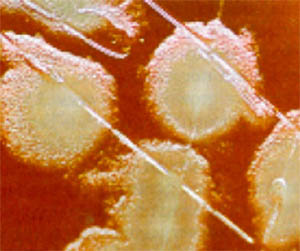 Устойчивый к антибиотикам штамм золотистого стафилококка — MRSA (фото с сайта www.ironhoof.fslife.co.uk)