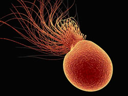  Pyrococcus furiosus      (   www.dbu.de)