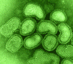 Вирус гриппа (на фото) ежегодно уносит до полумиллиона жизней (изображение с сайта www.zkea.com)