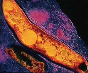 За время, которое пройдет с момента заражения этой бактерией до начала развития туберкулеза, отвечает ген NRAMP1. На фото — Mycobacterium tuberculosis (изображение с сайта biology.kenyon.edu)